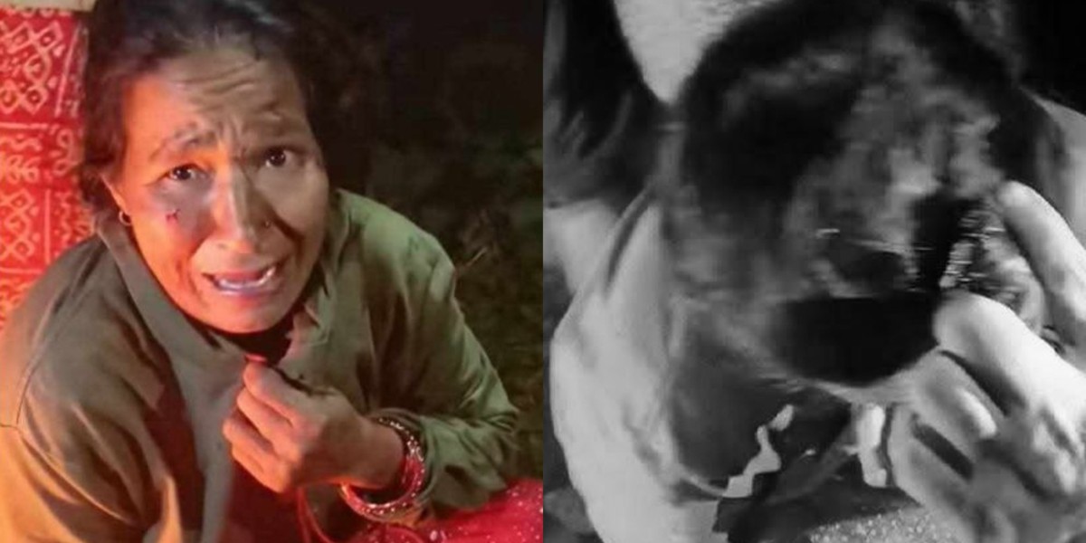 छाउगोठमा सुतेकी महिलामाथि बाघको आक्रमण